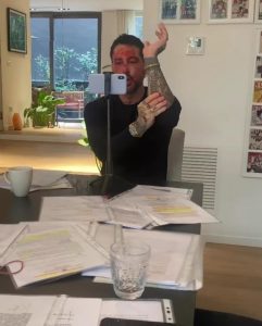 Revoca della pena domiciliare Fabrizio Corona appare col volto insanguinato 